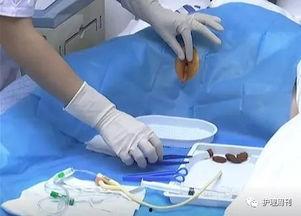 女人尿地方视频,尿路结构及生理功能解析